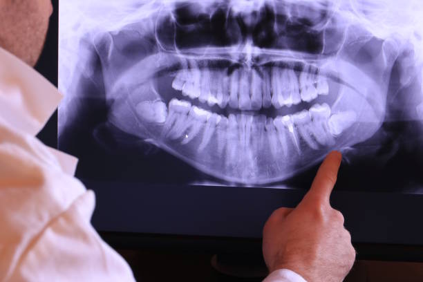 Best Broken or Cracked Tooth Emergency Dentist in USA
